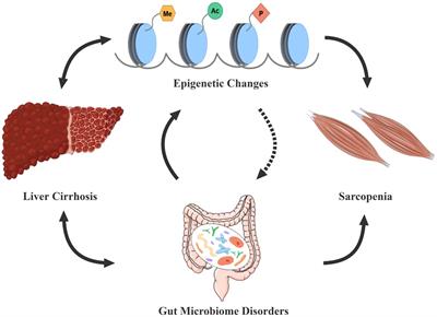 Sarcopenia in liver cirrhosis: perspectives from epigenetics and microbiota